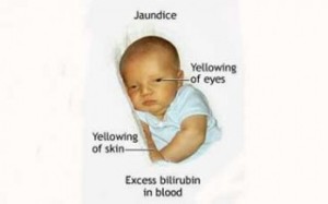 1397640673jaundice.jpg-320x200